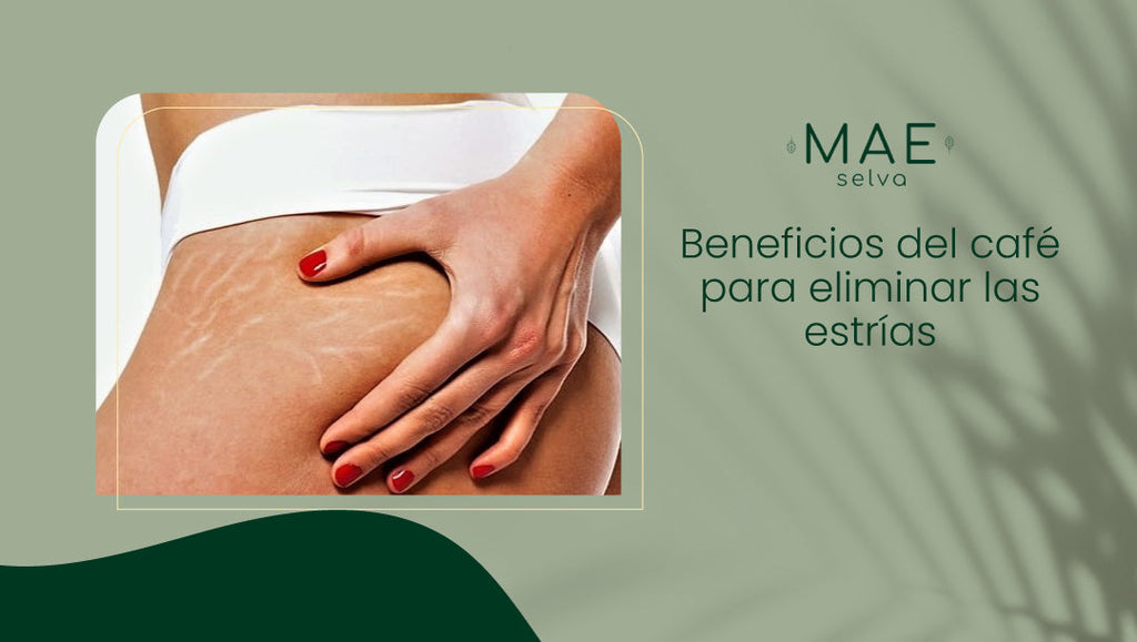 Beneficios del café para eliminar las estrías